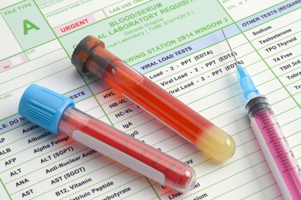 Decoding Your Blood Test: What Common Lab Results Can Tell You About Your Health